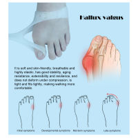 2 ชิ้นเจลแยกนิ้วเท้าใหญ่ Bunion Corrector ที่หนีบผมตรงนิ้วเท้า Crooked Toes Hallux Valgus Bunions เครื่องมือดูแลเท้า