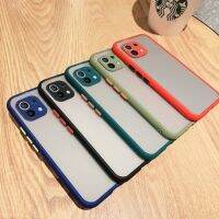 [คุณภาพดี] [ส่งจากประเทศไทย] ขอบสีผิวด้าน CASE XIAOMI MI 11 LITE เคสกันกระแทก ขอบนิ่มหลังแข็ง เคสมือถือ สามารถป้องกันกล้อง