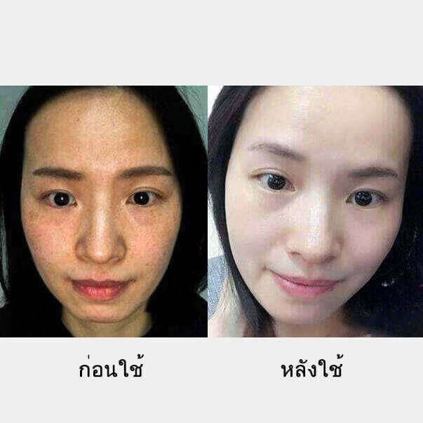 เรตินอล-ครีมเลือดมังกร-ครีมลบริ้วรอย-ครีมหน้าขาวใส-50g-ต่อต้านริ้วรอย-ลดฝ้ากระ-บำรุงผิวและยกกระชับผิว-ทำให้-ผิวขาว-กระจ่าง