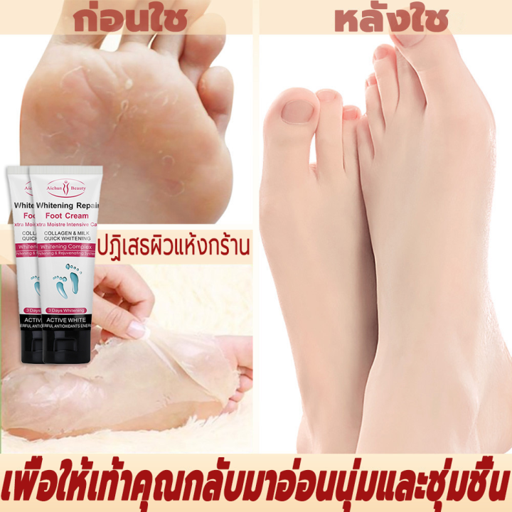 รักษาผิวเท้าแห้งแตก-ครีมทาตาตุ่มดำ-aichun-ครีมทาเท้าดำ-ครีมทาตีนขาว-ครีมทาเท้าขาว-ดูแลเท้า-รักษาผิวเท้า-บำรุงผิวเท้า-ครีมทาเท้าแตก-ครีมทาเท้า-ครีมบำรุงเท้า-เป็นขุย-ครีมส้นเท้าแตก-น้ำมันม้า-เท้าแตก-เท้