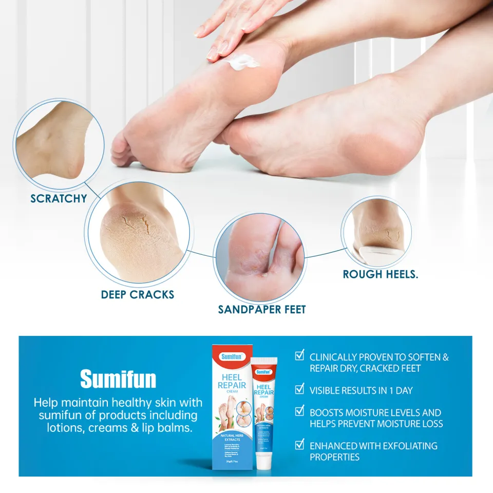 COD]Sumifun foot cream cracked heel remover hand cream for dry hands Foot  cream for Cracked heels callus removal for foot pair with callus remover  foot grinder callus cream remover Moisturizing Cracked Callus