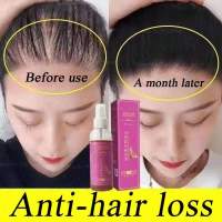 Hair Long and Parts Private In Quickly Growing From Hairline Bald Prevent To Liquid Growth Hair Anti-fall and Anti-fall Genuine