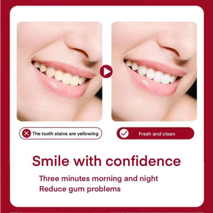 sp-4-ยาสีฟันฟันขาว-รุ่นอัพเกรด-sp4-ยาสีฟันฟอกฟันขาว-ยาสีฟันลดกลิ่น-ขจัดกลิ่นปาก-แก้ปวดฟัน-โปรไบโอติก-ยาสีฟัน-ยาสีฟันไวท์เทนนิ่ง