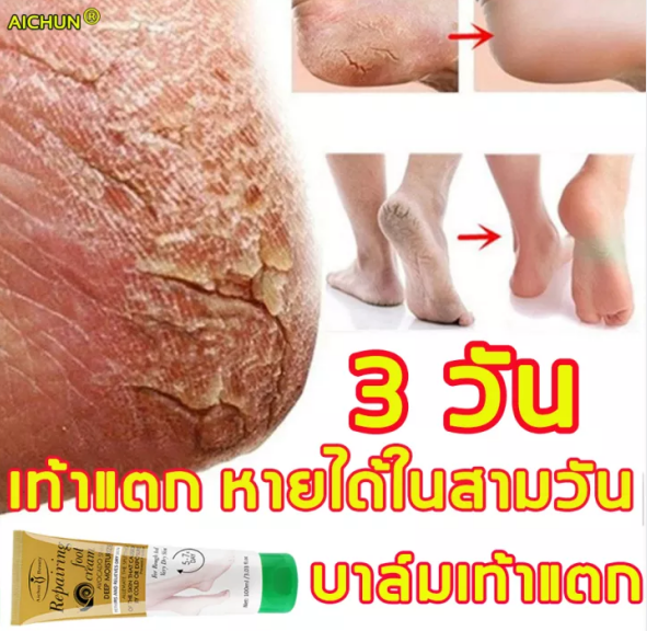 aichun-ครีมส้นเท้าแตก100ml-ครีมส้นเท้าแตก-100ml-เหมาะสำหรับส้นเท้าแตก-ผิวแตก-บำรุงผิว-ครีมสันเท้าแตก-ครีมทาเท้าขาว-ครีม