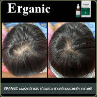 Erganic Hair Serum เซรั่มแก้ผมร่วง เพิ่มผมหนา ปลูกผม โดยแพทย์เฉพาะทางด้านเส้นผม มีหน่วยงานรัฐสนับสนุน คือ สสว. มธ. 1 กล่อง