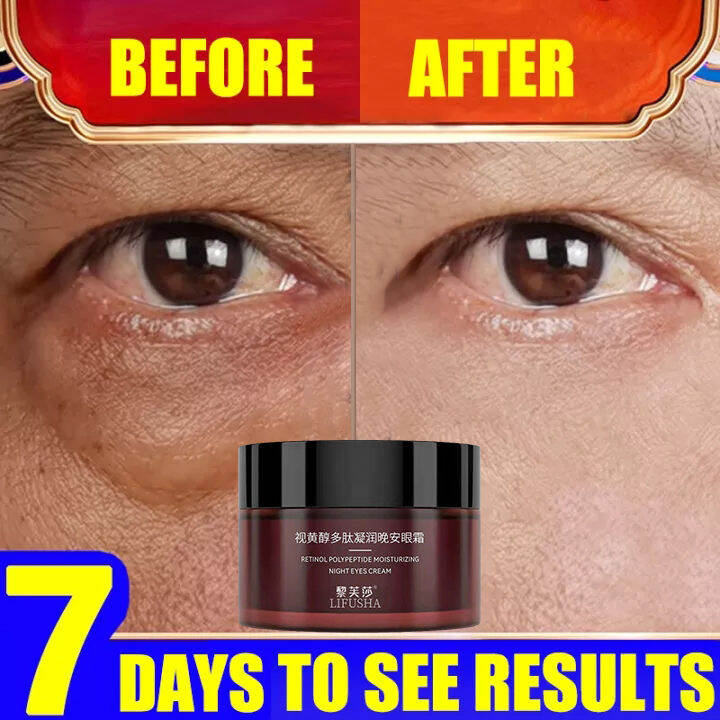 Retinol Eye Cream for Dark Circle Eyebags Remover Original Freebies Eye