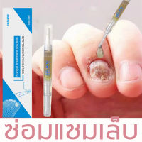 เซรั่มซ่อมแซมเล็บ ครีมซ่อมแซม  เล็บเชื้อรา Fungal Nail ฆ่าเชื้อราเล็บ บำรุงเล็บเสีย ยากันเชื่อราเล็บ（เชื้อราที่เล็บ โลชั่นบำรุงเล็บ ครีบบำรุงเล็บ ครีมบำรุงเล็บ เซรั่มรักษาเล็บ เชรั่มรักษาเล็บ ยาใส่เล็บเป็นเชื้อรา ยา หยอดเล็บ ครีมซ่อมแซมเล็บ น้ำยาฆ่าเชื้อร