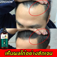 【ลดราคาครั้งใหญ่】ZENSHOW ยาสระผมแก้ร่วง แชมพูแก้ผมร่วง 500ml ช่วยการเจริญเติบโตของเส้นผมอย่างมีประสิทธิภาพ (ผมร่วงผมบาง แชมพูปลูกผม แชมพูขิงเพียว แชมพูขิงชุดรวม บำรุงหนังศรีษะ ผมแห้งเสีย ผมแตกปลาย ผมเรียบลื่น ปรับปรุงผมชี้ฟูและปมกัน ยาสระผมรังแค)