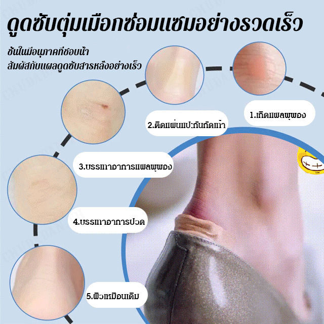 chudadan-สติ๊กเกอร์หน้าเท้าสำหรับส้นสูงชนิดเจลป้องกันการเกิดนูนแผลใต้เท้า