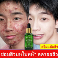 สกินแคร์ลดสิว ครีมรักษาสิว ลดสิว เซรั่มหน้ รอยสิว รอยแดง รอยดำจากสิซ่อมแซมผิวให้  ลดรอยแผลเป็นจากสิว คืนผิวสวยกลับมา