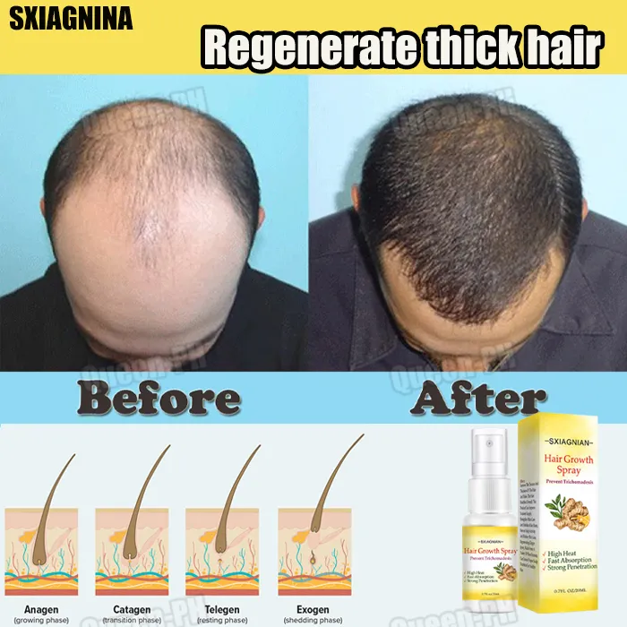 SIXAGNIAN Hair Growth Spray Hair Grower Fast Long Hair Quick Effect For Thick Hair Improves Hair Heath Prevent Trichomadesis Hair Treatment For Damage Hair Grower For Men For Women | Lazada PH SIXAGNIAN Hair Growth Spray Hair Grower Fast Long Hair Quick Effect For Thick Hair Improves Hair Heath Prevent Trichomadesis Hair Treatment For Damage Hair Grower For Men For Women | Lazada PH