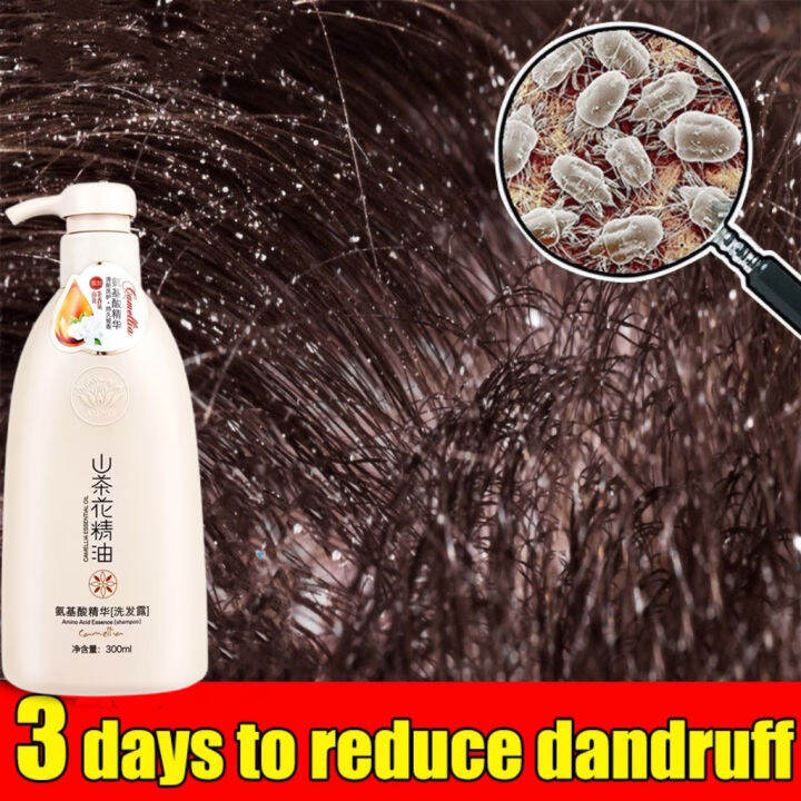 Anti Dandruff Shampoo 15 minutes lice removal shampoo for adults kids