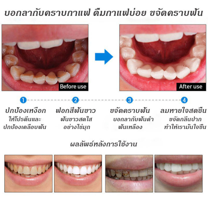 เห็นผลใน7วัน-ยาสีฟันฟันขาว-200g-ยาสีฟันเกลือทะเล-ฟอกฟันขาว-ยาสีฟันลดกลิ่น-คราบชากาแฟ-ยาสีฟันหินปูน-ฟอกฟันขาวแท้-กำจัดกลิ่นปาก-เสียวฟัน-ยาสีฟันโปรไบโอติก