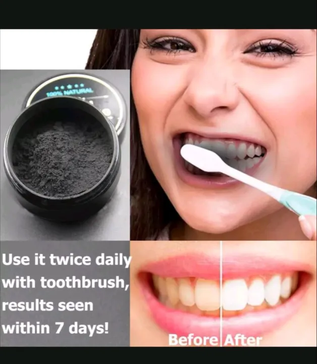 Natural Activated Charcoal Teeth Whitening Powder 30g Lazada PH