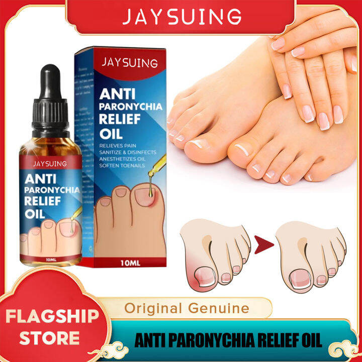 Jaysuing Anti Paronychia Relief Oil Cure Pain Reduce Ingrown Toenails