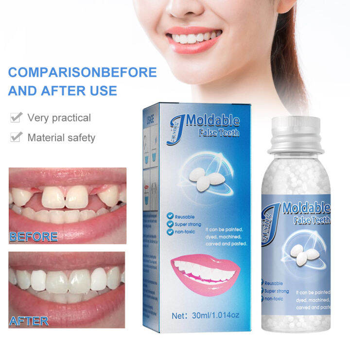 30ml Temporary Tooth Repair Kit Teeth and Gaps False Teeth Denture