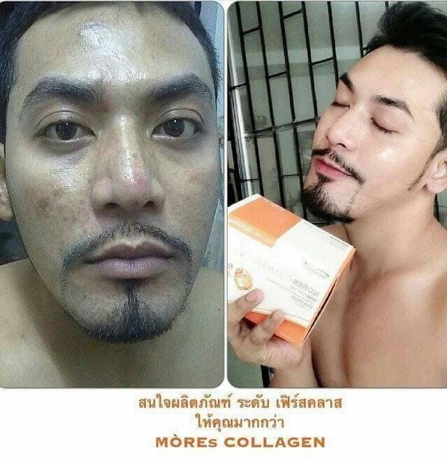 mores-collagen-มอร์ส-คอลลาเจน-ราชินีแห่งความกระจ่างใส