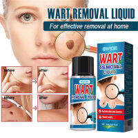 30ml Skin Care Wart Removal Liquid Universal No Stimulation Gentle Formula for Effectively Removing Stubborn Warts S6-TOP1A-TH