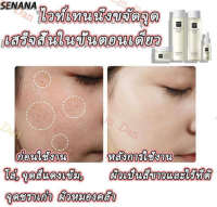 Senana?ครีมลบฝ้ากระ ครีมทาฝ้ากระ ครีมหน้าขาวใส 305ml เซตครีมหน้าใส ชุดไวท์เทนนิ่ง​ขจัด​ฝ้า​กระ ครีมทาหน้า ลดเม็ดสีเมลานิน ครีมทาฝ้าหนาๆ ครีมไวท์เทนนิ่ง ครีมสลายฝ้ากระ ครีมถาหน้าขาว ครีมแก้ฝ้ากระ ครีมทาฝ้าลึก ครีมฝ้ากระ เซรั่มบำรุงหน้า ครีมทาหน้าขาว ไวท์เ