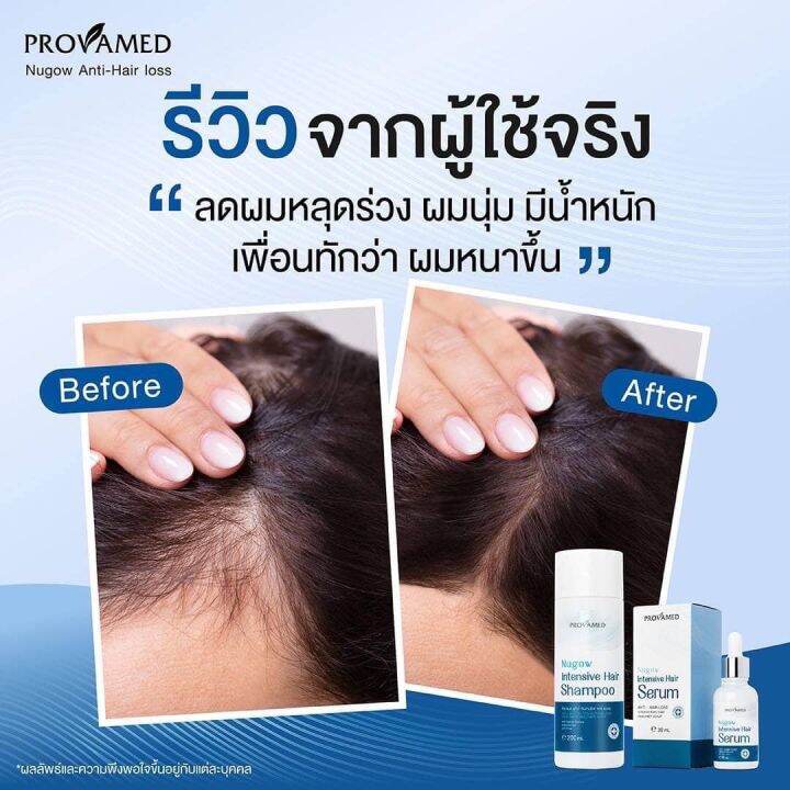 แชมพู-provamed-nugow-intensive-hair-shampoo-โปรวาเมด-นูโกว์-แชมพู-200-ml-แชมพูบำรุงเส้นผมและหนังศรีษะ