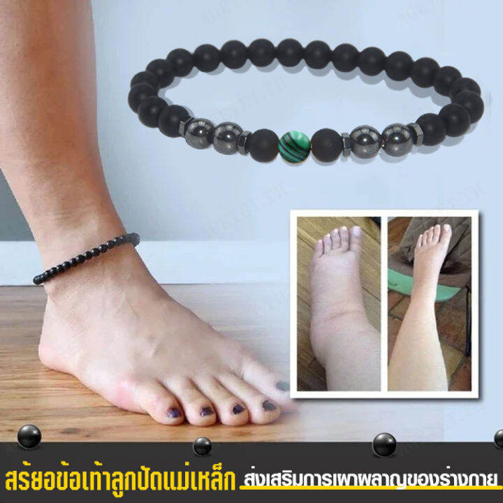 agetet-สร้อยข้อเท้า-หินฝ้า-แม่เหล็ก-ป้องกันอาการบวม-เครื่องประดับแฟชั่น