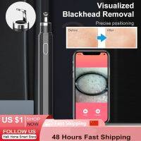 ZZOOI Visual Blackhead Remover Black Head Dots Removal Pen With Camera Face Cleaner Machine Acne Extractor Pimples Squeeze Skin Care