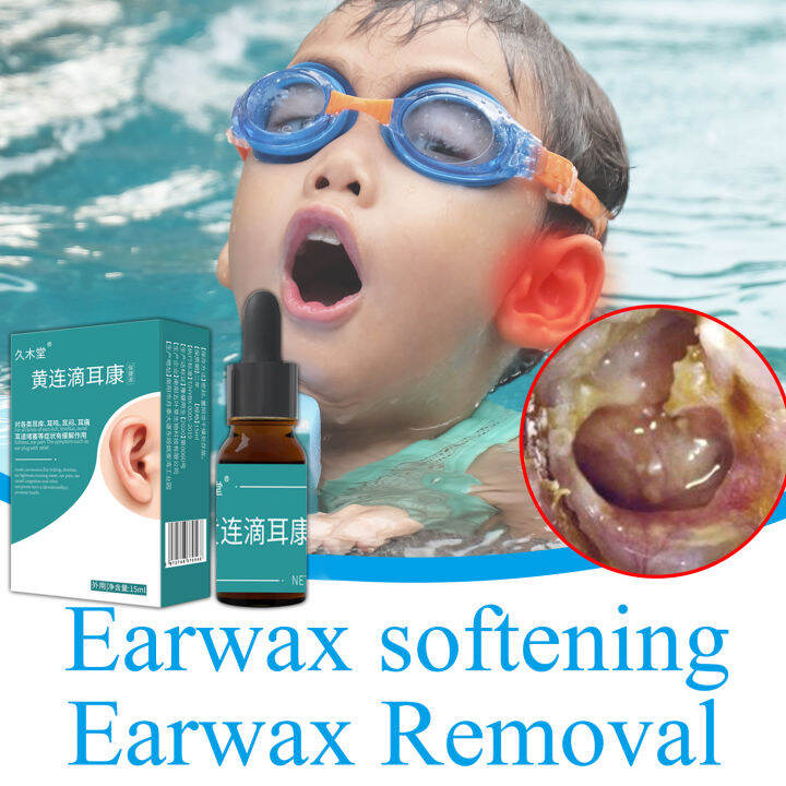 Natural Chinese Herbal Acute Otitis Ear Drops Ear Wax Ear Pain Care