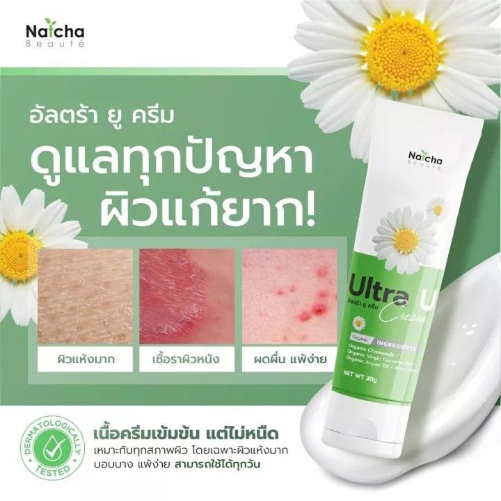 natcha-ultra-u-cream-อัลตร้า-ยู-ครีม-นัชชา-ณัชชา-สะเก็ดเงิน-ภูมิแพ้ผิวหนัง