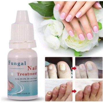 *ส่งจากไทย* Fungal Nail น้ำมันบำรุงเล็บ รักษาเล็บ เล็บขบ เชื้อรา สมุนไพรรักษาเล็บขบ *หลอดเล็ก สีฟ้า* รหัส 5028