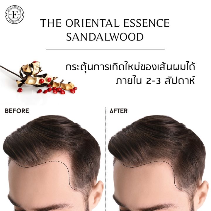 สเปรย์ปลูกผมที่ดีที่สุด-the-oriental-essence-sandalwood-ป้องกันผมร่วง-ผมบาง-ศีรษะล้าน-100-ml