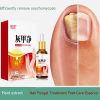 Nail Fungal Treatment Feet Care Essence Nail Foot Whitening Toe Nail Fungus Removal Gel Anti Infection Paronychia Onychomycosis