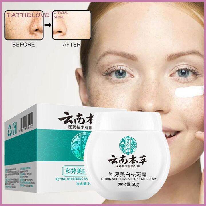 Tattielove 雲南本草 美白祛斑 KETING Whitening And Freckle Cream 50g ...