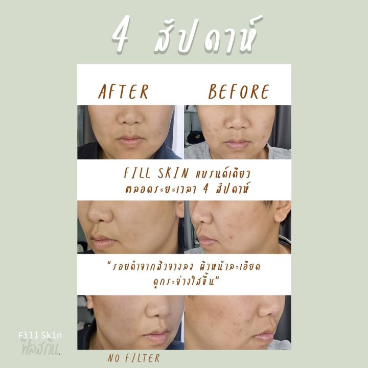 สินค้าใหม่-fill-skin-ครีมทาฝ้า-ขาว-ใส-ลดฝ้า-กระ-จุดด่างดำ-day-amp-night-2-ชิ้น-ใน-1-กล่อง