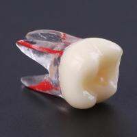 1Pc 1:1เรซิ่น Endodontic รุ่นสีราก Canal และ Pulp เครื่องมือสำหรับนักเรียน Study Practice