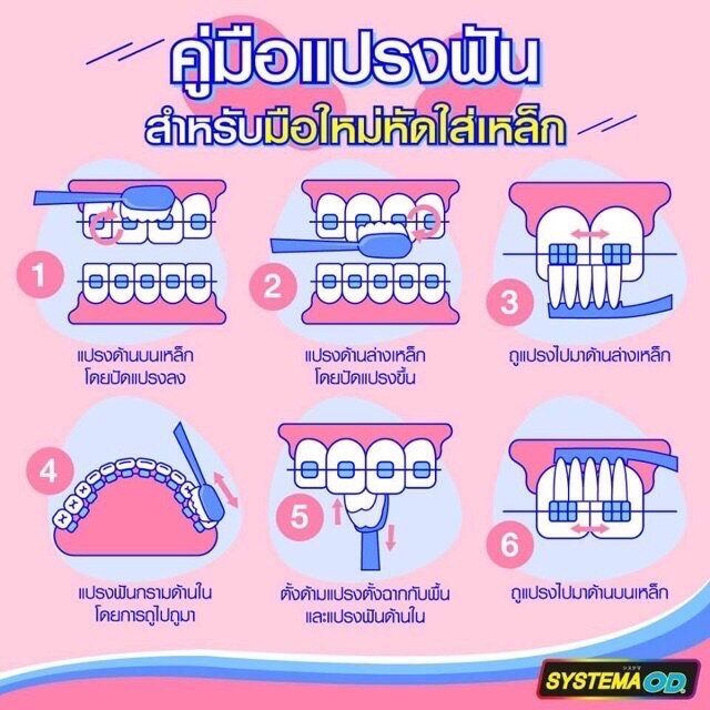 systema-od-แปรงสีฟัน-ซิสเท็มมา-โอดี-สำหรับคนจัดฟัน-ไซส์-s-m