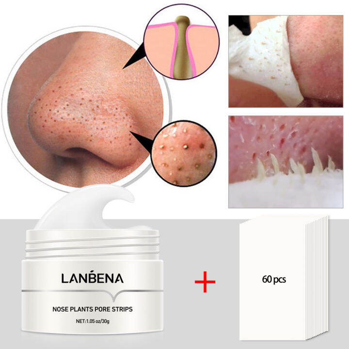 LANBENA Aloe Vera Blackhead Remover Strips Pore Minimizer Acne