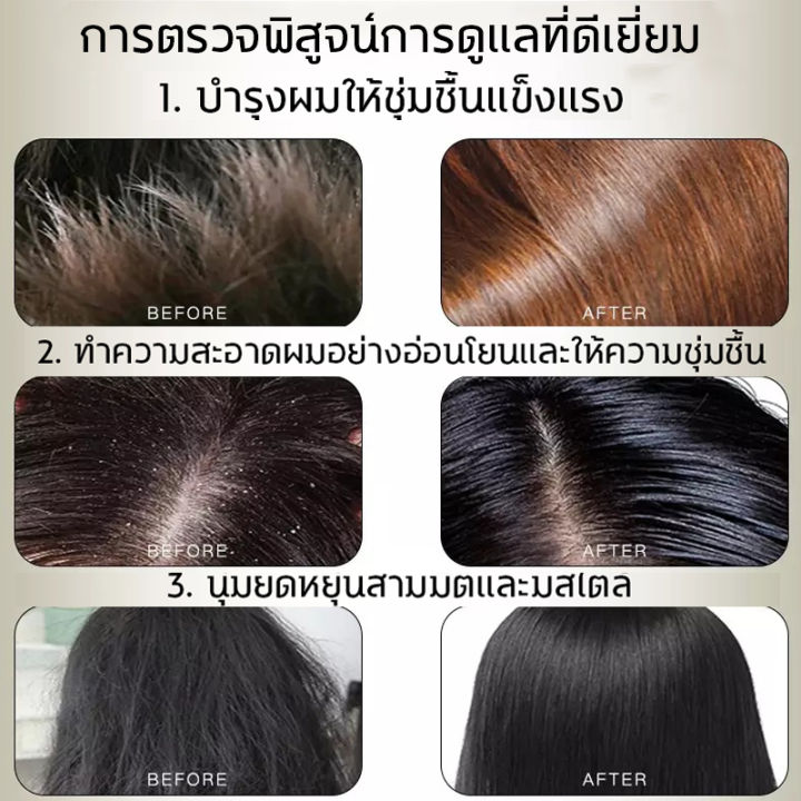 ของแท้100-zenshow-แชมพูขิง500mlแชมพูชายหญิง-ปลูกผม-ยับยั้งรังแค-แชมพูลดผมร่วงขิงช่วยป้องกันผมร่วง-ยาสระผมแก้ผมร่วง-แชมพูสมุนไพร-แชมพูขิงเพียว-ยาสระผมแก้ผมร่วงสูตรแก้ปัญหาผมร่วง-แชมพูแก้ผมร่วง-แชมพูสระ