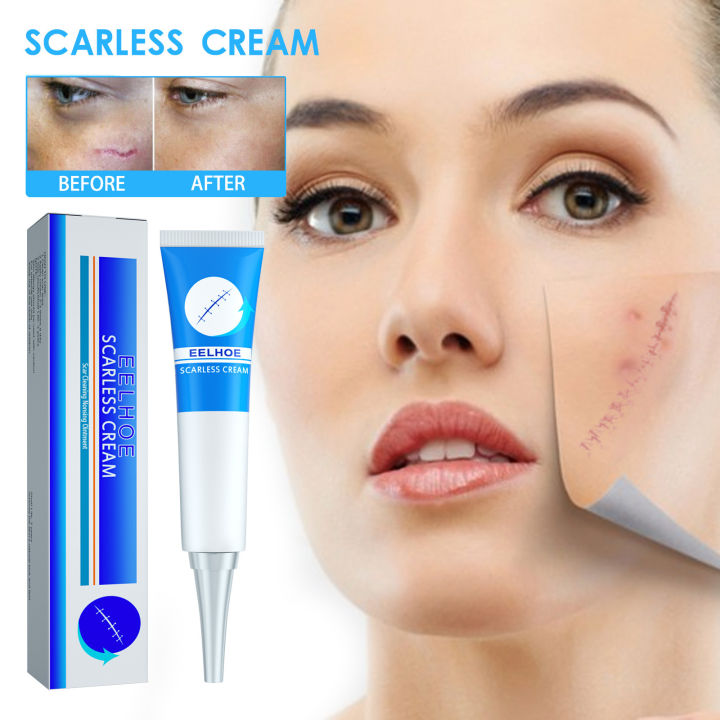 Eelhoe Scar Removal Cream Repair Skin Fading Scar Soothing Marks Smooth ...