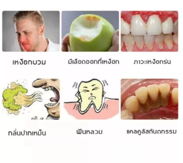 ลดฟันเหลือง-ป้องกันฟันผุ-ยาสีฟันน้ำผึ้งธรรมชาติ-bangchiling-ลดหินปูน-คราบฟัน-ปวดฟัน-มูสฟอกฟันขาว-ยาสีฟันน้ำผึ้ง-ยาสีฟันฟอกขา-ยาสีฟัน-ยาสีฟันขจัดปูน-ฟันผุ-ยาสีฟันฟันขาว-ปวดฟันผุ-ฟันขาว-น้ำยาขัดฟันขาว-ย