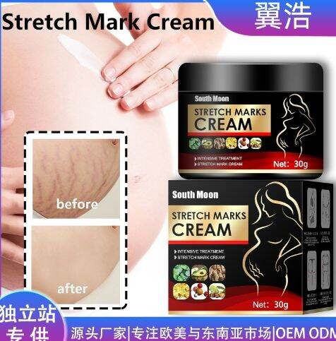 Pregnancy Firming Repair Cream for wrinkled skin | Lazada PH