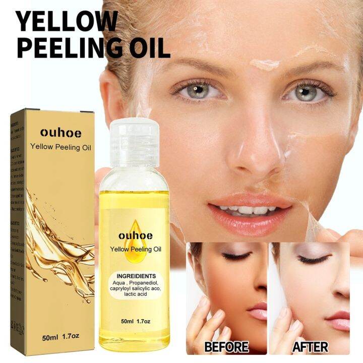 Yellow peeling oil Deep clean Face exfoliating Whitening Moisturizer