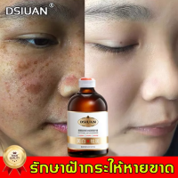 ครีมทาฝ้า 100ml ลดฝ้ากระที่ฝังลึก กำจัดฝ้า จุดด่างดำ ฝ้า กระ กระจ่างใสผิว ลดเม็ดสีเมลานิน ครีมทาฝ้าลึก ครีมหน้าขาวใส ครีมทาฝ้ากระ ครีมฝ้ากระ ครีมทาหน้าขาว ครีมกระไวท์เทนนิ่ง ไวท์เทนนิ่งครีม ครีมไวท์เทนนิ่ง บำรุงผิวหน้า ครีมรักษาฝ้า ครีมแก้ฝ้าลึก