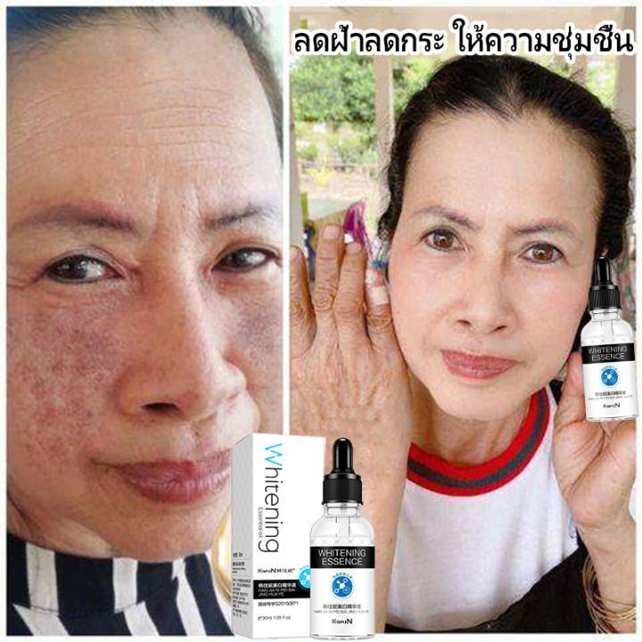 นิสิตเซรั่มแท้-นิสิตเซรั่มฝ้า-เซรัมนิสิต-เชรั่มหน้าใส-เซรั่มลดฝ้ากระ-เซรัมหน้าขาวใสก-ระชับรูขุมขน-ลือนจุดด่างดำ-ลดเมลานิน-เติมเต็มความชุ่มชื้นให้ผิว-whitening-serum