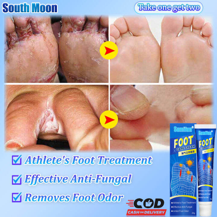 Sumifun Athlete's foot cream Treatment of athlete's foot fungal