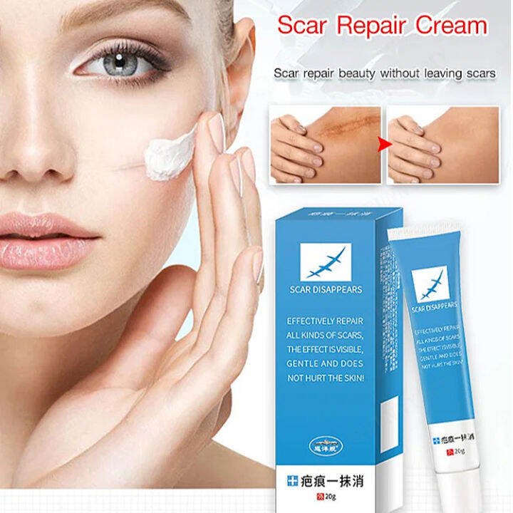 greatfunny Scar Healing Cream for Surgical Scars and Bruises Personal ...