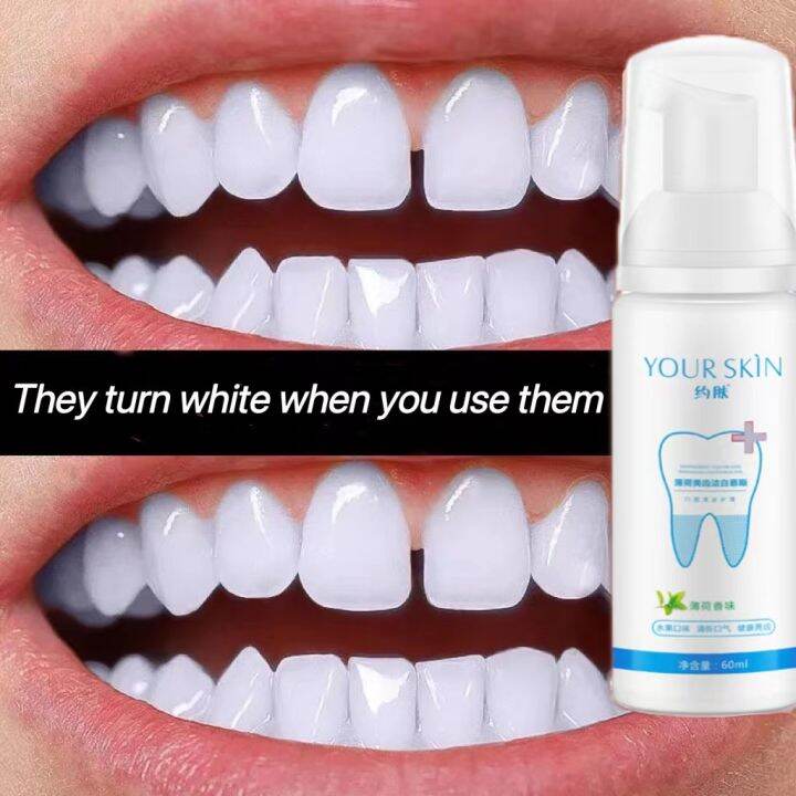 【COD】Teeth Mousse Whitening Removes Stains yellowing and halitosis removing fresh breath Teeth
