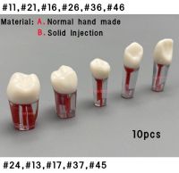 {:“》:”การศึกษาฟันคลองรากฟัน10ชิ้นเล็บปลอมสำหรับฝึกทาการฉีดไฟล์รากฟันที่บุโพรงมดลูก RCT แทนที่ฟันเรซิน