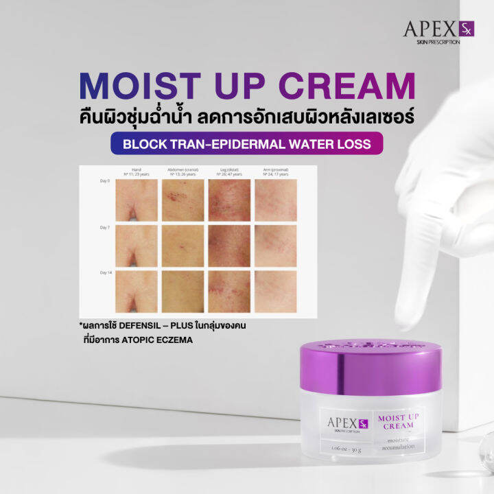 apex-sx-moist-up-cream-ผลิตภัณฑ์ครีมบำรุงผิวหน้าอุดมไปด้วย-moisturizing-มอบความชุ่มชื้นแก่ผิวได้อย่างยาวนาน-120-ชั่วโมง