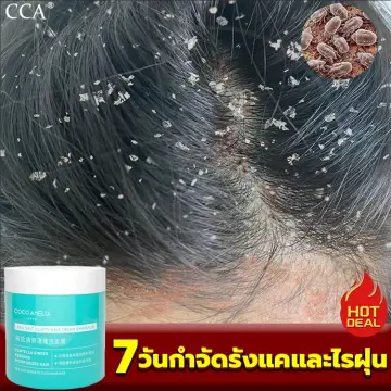 ยา สระ ผม แก้ ผม มัน ราคาถูก ซื้อออนไลน์ที่ - มิ.ย. 2023 | Lazada.Co.Th