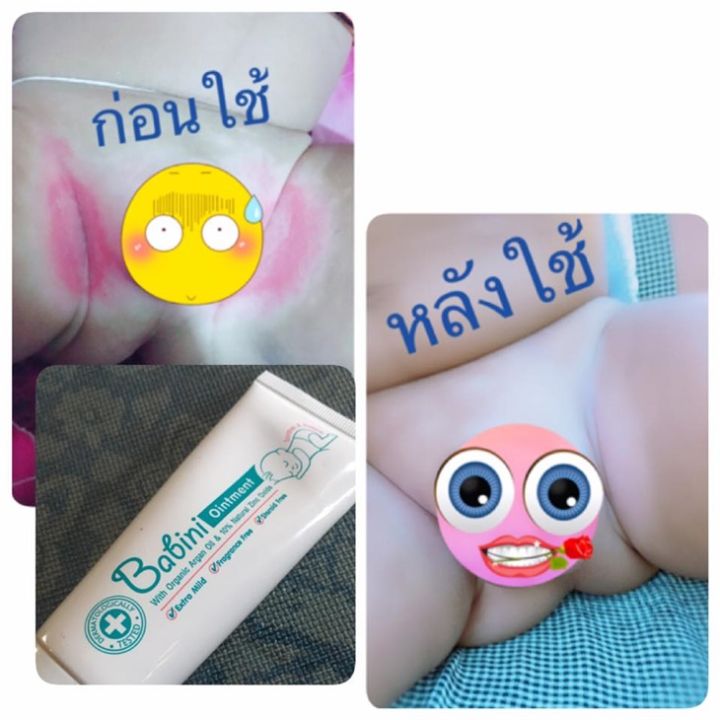 babini-ointment-เบบินี่-ออยเมนท์-50-g-ดูแลผิวจากผื่นผ้าอ้อม-ผดผื่น-อาการระคายเคือง